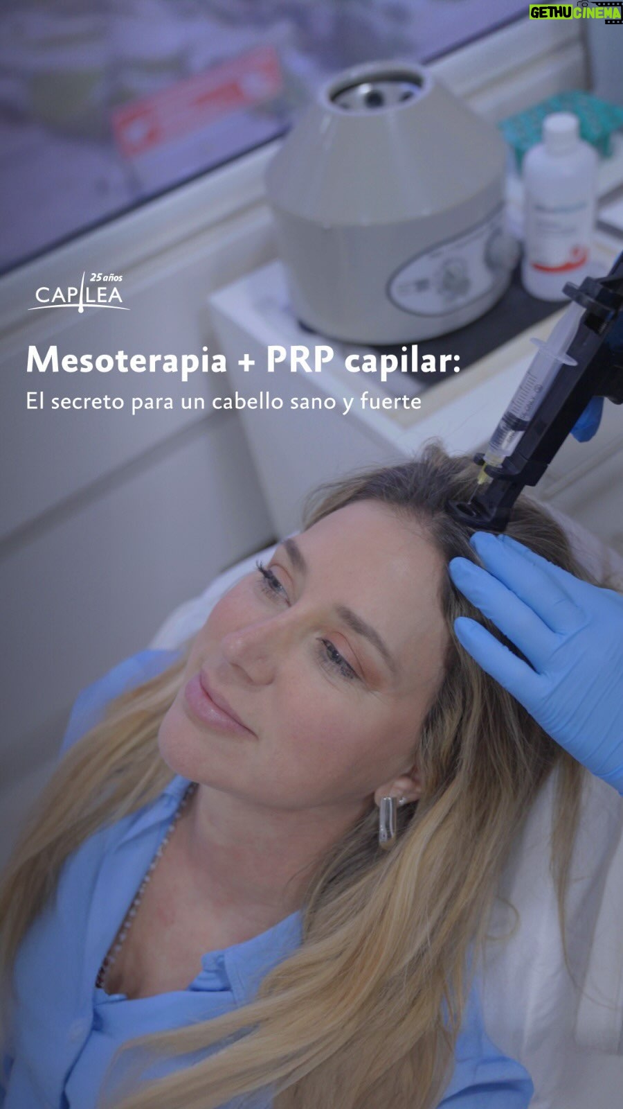 Flaviana Seeling - 687 Likes - Acompáñanos en una sesión de cuidado capilar con @flavianaseeling 🤩
En su caso, preparamos un tratamiento estimulativo que combinó PRP capilar mesoterapia capilar, un mix súper potente y efectivo para:
✨Fortalecer el cabello.
✨Estimular el crecimiento.
✨Aumentar la densidad.
✨Mejorar la calidad y grosor del cabello.
✨Revitalizar el cuero cabelludo.
¿Quieres saber más sobre nuestros tratamientos? Consúltanos por WhatsApp o mensaje privado y agenda una cita de diagnóstico en Capilea.
📲 Sede Talca: 56 966 224 113
📲 Sede Concepción: 56 923 968 588