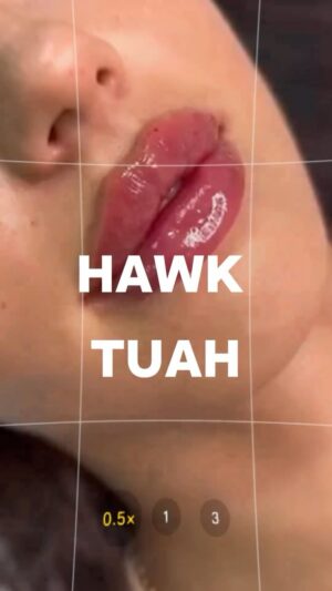 Gabriela Castrovinci Instagram - Enhance Your Beauty with Our HAWK TUAW! Lip Fillers & Neurotoxin!** 💋✨

At **BabyFaces MedSpa**, we specialize in creating the perfect HAWK TUAH DLS LIP just for you. Whether you’re looking to add volume, define your lip shape, smooth out fine lines, or get rid of wrinkles, we’ve got you covered! 🌟

🌟 **Special Offers:**
* **💋 Lips:** $100 off 
* **💉 Neurotoxin:** $7.99 per unit only!

📍 **Locations:**
* **Bethel, CT:** 📞 203.859.0266
* **Tampa, FL:** 📞 813.999.6133

🌐 Visit our website: [www.babyfaces.com])🌟

📸 Follow us on Instagram: [@babyfaces_medspa] 📸

**Book your appointment today and let us help you achieve the lips of your dreams!** 🌸💖