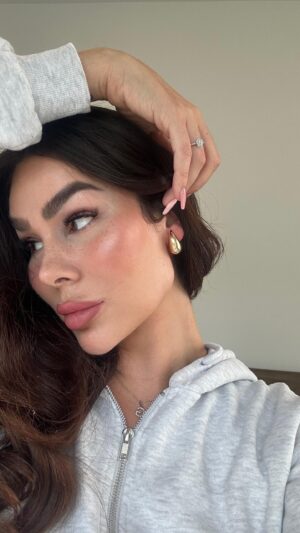 Gabrielle Marion Instagram - Pour les haters qui commentent sur mes fillers aujourd’hui, vous avez manqué les meilleures années.. 🙃😂🤷🏻‍♀️ 

#fyp #eyebrowblindness #lipfiller #humour