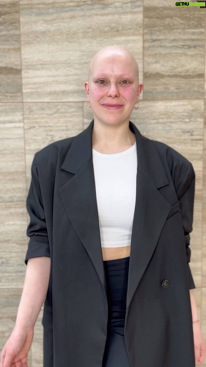 Gigi Era - 7K Likes - I’m so proud of my work and to be able to help others is AMAZING feeling.
Meet @olitomazic – Our Real-Life Confidence Queen 👑
Olivia, an inspiring alopecia warrior, found her strength and beauty in the flawless wigs from @humanhairwigsbydave
No more hiding, no more doubts. With every wig, Olivia shines with confidence. 💖
Your story matters. Share it. 📖 #ConfidenceUnveiled #HumanHairByDave
#humanhair #wigs #custommade #madeinaustralia #hairstyle #blondehair #dragqueen #dragrace #100%humanhair #wigsbydave #lace #premuim #medicalwig #alopecia #nomore #