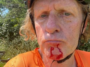Grayson Perry Instagram - For those of you that followed my ride across France I can report I am feeling much more zippy on a bike 
Mountain biking is still hard work and a bramble across the face stings
Spot the hand reared ram is very tame and stole our cheese straws