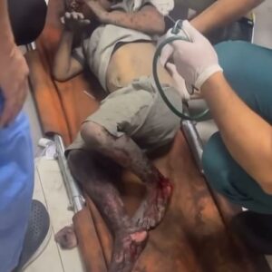 Haluk Piyes Instagram - - …but, Do you Condemn Hamas? -

How dare u can still ask this???

 In Gaza 7326 dead including 3038 children and 1792 women. The wounded are 18967. Among these hundreds and hundreds without legs and arms. Meanwhile a consistent slice of western press, in the midst of a disgusting carnage, the only question they can ask is this... This baby has survived, so far.
Look for yourself the terror of war, the terror of bombing just now.
This is not self-defense. This is genocide. Can that barbaric terrorist attack justify a retaliation that goes infinitely beyond the law of bribery?
Do you realize that these children can't even escape living in Gaza, therefore in the biggest prison in the world for 75 years? Rightly, I repeat, rightly have been shown in national news the images of the indecent terrorist attack by Hamas. Why aren't these images shown too? Why? Why? This isn’t about Hamas and revenge….USA Austria and Germany are no suprise for us but some abstentions will not be forgotten!!! 

#LiberatePalestine
#GazaGenocide
