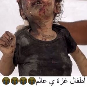 Haluk Piyes Instagram - - …but, Do you Condemn Hamas? -

How dare u can still ask this???

 In Gaza 7326 dead including 3038 children and 1792 women. The wounded are 18967. Among these hundreds and hundreds without legs and arms. Meanwhile a consistent slice of western press, in the midst of a disgusting carnage, the only question they can ask is this... This baby has survived, so far.
Look for yourself the terror of war, the terror of bombing just now.
This is not self-defense. This is genocide. Can that barbaric terrorist attack justify a retaliation that goes infinitely beyond the law of bribery?
Do you realize that these children can't even escape living in Gaza, therefore in the biggest prison in the world for 75 years? Rightly, I repeat, rightly have been shown in national news the images of the indecent terrorist attack by Hamas. Why aren't these images shown too? Why? Why? This isn’t about Hamas and revenge….USA Austria and Germany are no suprise for us but some abstentions will not be forgotten!!! 

#LiberatePalestine
#GazaGenocide