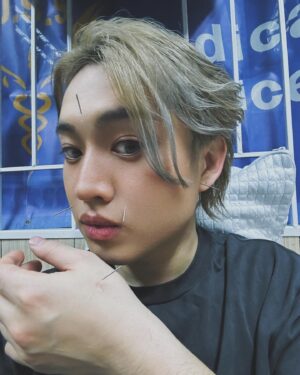Jeremy Lau Instagram - 仲有Last Day先黎病🥲
撐過了瘋狂鼻水倒流同咳嘅一日
謝謝醫療團隊同我針灸😭🙏🏻