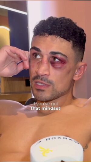 Jordan Gill Instagram - “I DON’T NEED BOXING”
.
Despite his loss, @itsjordangill was kind enough to give us a few moments of his time last night. You can watch the full interview on our youtube channel (LINK ON BIO)
.
#matchroomboxing #ukboxing #boxingfans