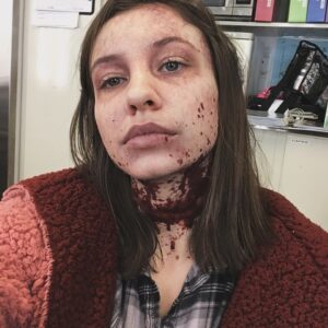 Katelyn Nacon Instagram - How I feel rn sick af🫠