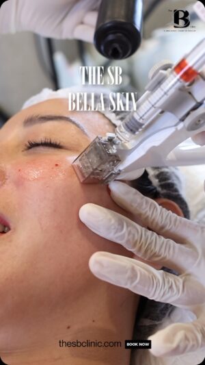 Katrina Halili Instagram - Regenerate, Whiten, Hydrate - All in One Session! ✨

Discover SB Bella Skin with Ms. Katrina Halili (@katrina_halili) at #TheSBClinic! It promotes tissue repair, stimulates cell growth, and restores skin structure.🌟 Experience intense hydration from within, leaving your skin supple and healthy.💧 Enjoy the powerful whitening effect of Glutathione, which enhances skin tone and reduces melanin production. Transform your skin in just one session with #SBBellaSkin! Delivering immediate results in skin regeneration, whitening, and deep hydration. 💖 Embrace the revitalizing power of SB Bella Skin today and book your appointment!📆
📍Visit us at Level 2 Metrofocus Building, #42 Tomas Morato, Quezon City. 
📲0917-1737685
🌐www.thesbclinic.com