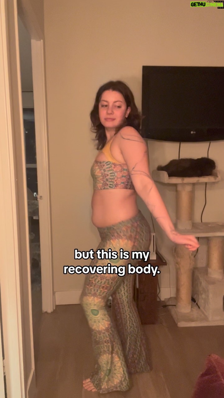 Keara Graves - 12.3K Likes - i had more weight to gain, and maybe i still do, but now i trust that my body is doing what’s best for me to heal 🤍✨
#edrecovery #bodyimagehealing #healingjourney #selflove #bodydysmorphiarecovery #recovery #bodyconfidence #bodypositive