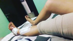 Larasati Nugroho Instagram - Posting ga ya posting ga yaaaa hmmmmmm iseng ah posting ajaaaaah well ..... its ma scar its me :) ma own story 🙏 journey of ma life ...
(Opo sih ras ngemeng baè)  JANGAN DI LIAT BUAT YANG TAKUT JIJAY DSB😅✌ buat yg pernah ngalamin hal yg sama kalian hebaaattttttt.....buat yg lagi rasa in yuk kuat yuk... dan yg ga pernah rasain hal ini hehehehe jangan sampe ya 🙏😘 bersyukur dan beruntung masih hidup hihi makasie banyak Tuhan Yesus ... luv sekalee untuk mama...kluarga dan temen-temen yg support akohh sayang kalian banet deh💙💙💙💙💙💙💙 Dah ah gtu aja sih hoho have a great day!!!💝peeeeppssssss *btw abaikan kaki endut sayah yg ga kontrol ituh yah🙈😘