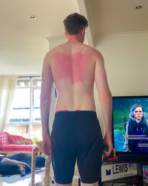 Lewis Spears Instagram - Hey everyone I ruined the first day of 2024 can we have a do over? I’m in a lot of pain.
P.S. always ask a friend to do the part of your back you can’t reach