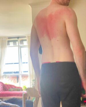 Lewis Spears Instagram - Hey everyone I ruined the first day of 2024 can we have a do over? I’m in a lot of pain.
P.S. always ask a friend to do the part of your back you can’t reach