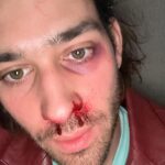 Maxim Baldry