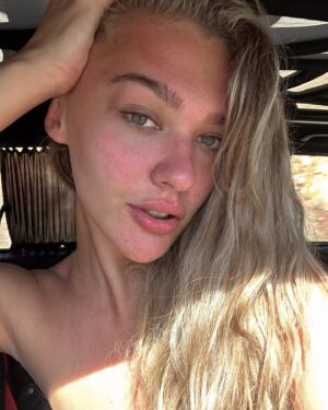 Melisa Döngel Instagram - estetiğe hayır