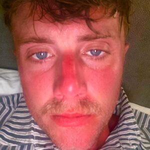 Roman Kemp Instagram - ⚠️ A slideshow of why you should wear SPF in Montenegro 🇲🇪