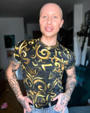 Ryan Boa Instagram - 🥹Proud Of Myself🥹

✨Some days are easier than others, but today marks four years and ten months of my sobriety journey✨

🌿Starting recovery was the best step I could have ever made in my life and I’m so grateful to be standing here today as I continue to become the best version of myself🌿

If you or someone you know is struggling with addiction, click the link in my bio for resources! 

Boa
💚💖

#sobriety #recovery #recoveryjourney #health #sober #drag #dragqueen #dragrace #canadasdragrace #rpdr