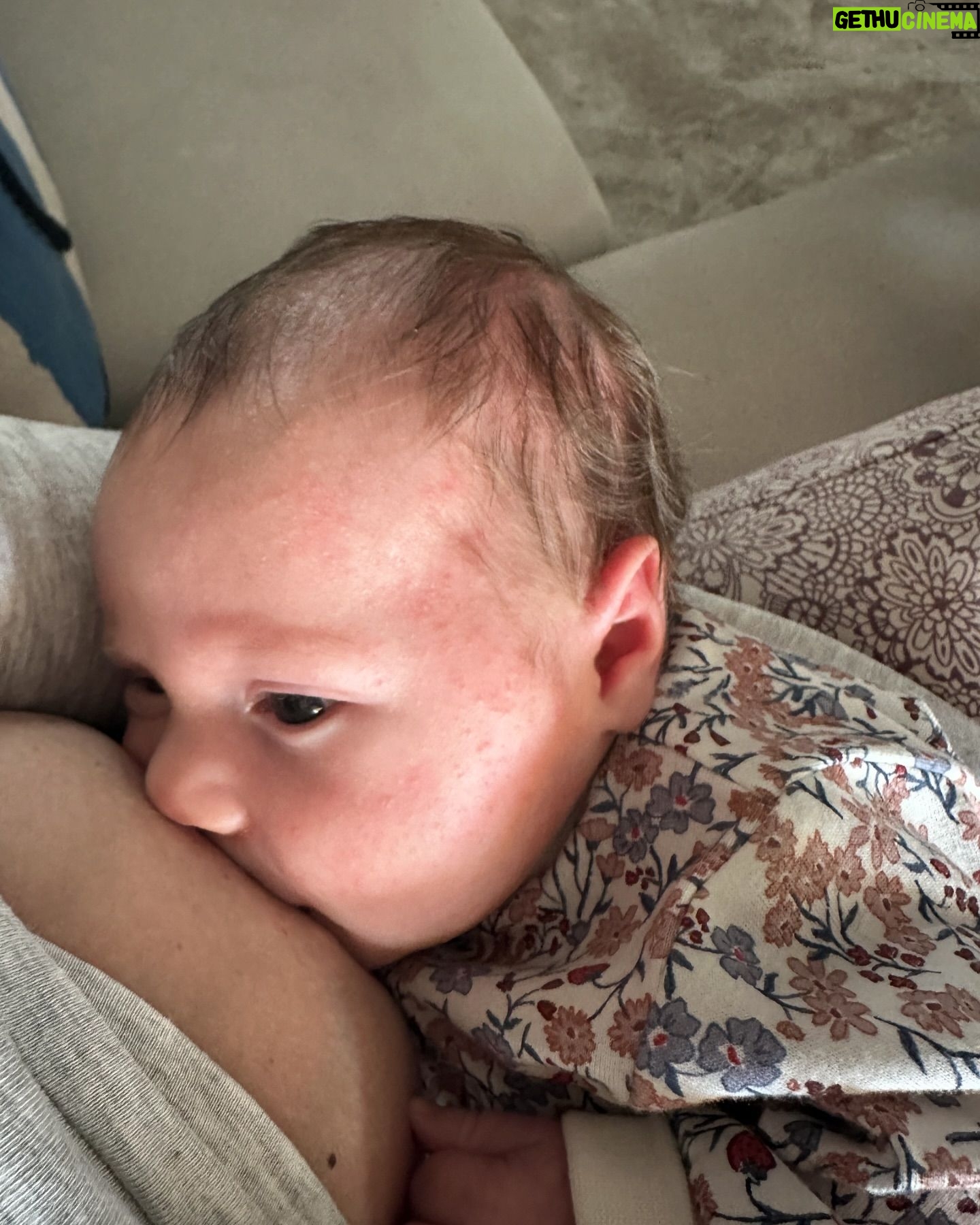 Sofia Arruda - 34.2K Likes - A nossa Nenuca faz alergia à proteína do leite de vaca- APLV. Nunca pensei em tal coisa, porque ela mama em exclusivo e nunca lhe dei leite nenhum além do meu. Mas logo após fazer 1 mês ela começou a ficar com borbulhinhas no rosto que ficaram piores a cada dia que passava e bolsava muito ( de jato e às vezes leite da mamada anterior do género requeijão) . Eu pensei “tem refluxo e a pele está a habituar-se ao meio extra uterino”, mas não, a Dra. Joana Appleton que é também pediatra do Xavier, disse-me para deixar de comer alimentos com proteína de leite de vaca. Eu pensei que era alergia à lactose mas não, é tudo o que tem proteína de leite de vaca e é a mãe que tem de deixar de comer porque passa para o leite materno. Ou seja, não basta comer iogurtes/leite/queijo sem lactose, temos mesmo de passar para as opções vegetais. (também convém evitar a soja)
No nosso caso, depois de fazer esta alteração alimentar, em 4 dias ela melhorou imenso ! Hoje não tem nada no rosto e bolsa muito muito raramente. 🙌🏼
Os sintomas podem incluir também diarreia, inchaço nos olhos, dificuldade em dormir, dificuldade em respirar…
Sei que há recentes mamãs por aqui e quis deixar o meu testemunho porque pode ajudar os vossos bebés. ( a primeira fotografia é agora, as outras e os vídeos são de quando ainda não tínhamos identificado o problema)
Espero ajudar ❤️🙌🏼