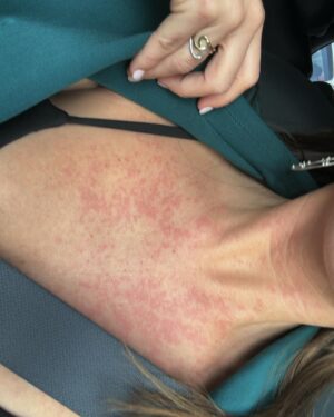 Tita Ureta Instagram - mi cuerpo me hablaba. y no quise escucharlo. seguí, enferma, con reacciones alérgicas, a ciegas. quería cumplir con todo. a veces pienso que las puedo hacer todas, pero pucha que es importante escucharse y parar. toqué fondo y aquí estoy en mi cama en reposo, para recuperarme y volver a empezar, sana. gracias a quienes me cuidaron. abrazo a todos quienes están enfermos o con energías más bajas 🫶🏽