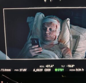 Tom Glynn-Carney Instagram - took me ages to work out how to post this. Scroll for when I began trying…

clever people who should be thanked:

#HannahEccleston
@waldomason 
@amandaknightmonger 
@rosalia_culora
@island_makeup_studio 
@heather__mcmullen 
@emmafaulkes 
and many more.