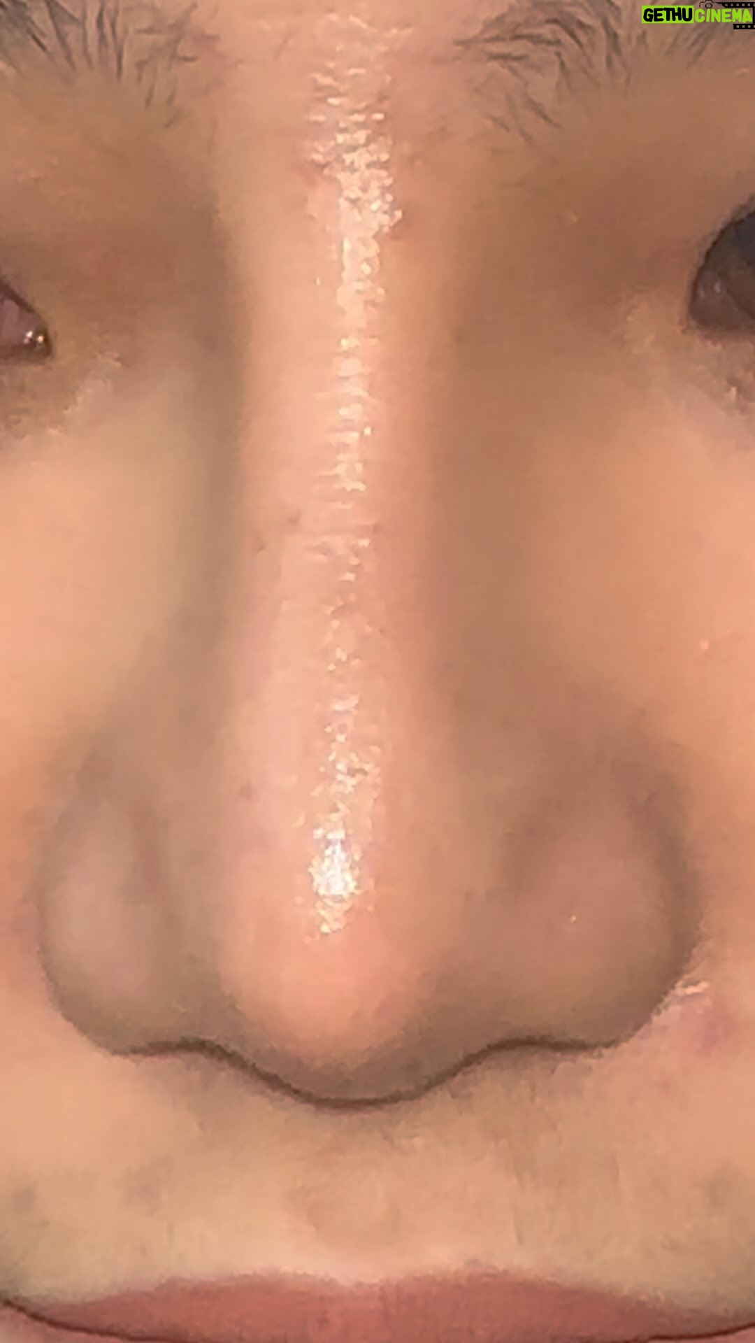 Tompi - 671 Likes - Ini penjelasan kenapa implant hidung gak bs NATURAL HASILNYA