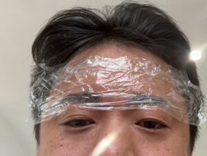 Yumemaru Instagram - ちょっと前に初めて眉毛サロンに行ってきました🐸
意外と左右でまばらに生えてるみたい、、
どうやったら眉毛均等に生えるん??

1枚目　施術前
2枚目　施術後
3枚目　アイブロウあり
4枚目　暇人。

どれが良い?