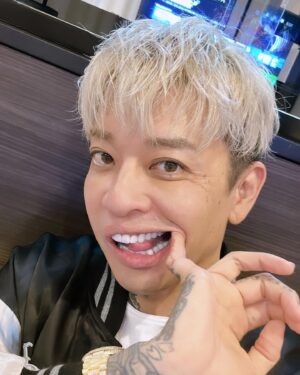 t-Ace Instagram - 絶賛シミ取りのダウンタイム中だけど載せとく。上下20本のあたらしい歯が入った🦷歯医者も嫌いだし、虫歯になりやすいし、コンプレックスもあったしこれで解消されると思うとテンションあがる。ずっと欲しかった八重歯もできた。できれば毒とか出せたらいいのに。歯は大事なものだからちゃんと信頼できる仲間の医院でやりたかった。オレはお金をもらってみんなに何かをすすめるPR案件とかはやらないからホントに自分でいいな、こいつになら預けられるなって思ってちょっと離れてるけどここにした。この歯科を紹介するのももちろん無償でしてる。とにかく真面目でいい先生達だからすすめとくね！
テラスモール松戸プランス歯科
☎️0477005185
自分が試してみんなに教えたいなって思った物以外のPR案件みたいなの受け付けてない！
#tAce #エロ神クズお #pr #宣伝 #ジルコニア