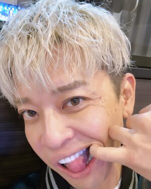 t-Ace Instagram - 絶賛シミ取りのダウンタイム中だけど載せとく。上下20本のあたらしい歯が入った🦷歯医者も嫌いだし、虫歯になりやすいし、コンプレックスもあったしこれで解消されると思うとテンションあがる。ずっと欲しかった八重歯もできた。できれば毒とか出せたらいいのに。歯は大事なものだからちゃんと信頼できる仲間の医院でやりたかった。オレはお金をもらってみんなに何かをすすめるPR案件とかはやらないからホントに自分でいいな、こいつになら預けられるなって思ってちょっと離れてるけどここにした。この歯科を紹介するのももちろん無償でしてる。とにかく真面目でいい先生達だからすすめとくね！
テラスモール松戸プランス歯科
☎️0477005185
自分が試してみんなに教えたいなって思った物以外のPR案件みたいなの受け付けてない！
#tAce #エロ神クズお #pr #宣伝 #ジルコニア