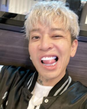 t-Ace Instagram - 絶賛シミ取りのダウンタイム中だけど載せとく。上下20本のあたらしい歯が入った🦷歯医者も嫌いだし、虫歯になりやすいし、コンプレックスもあったしこれで解消されると思うとテンションあがる。ずっと欲しかった八重歯もできた。できれば毒とか出せたらいいのに。歯は大事なものだからちゃんと信頼できる仲間の医院でやりたかった。オレはお金をもらってみんなに何かをすすめるPR案件とかはやらないからホントに自分でいいな、こいつになら預けられるなって思ってちょっと離れてるけどここにした。この歯科を紹介するのももちろん無償でしてる。とにかく真面目でいい先生達だからすすめとくね！
テラスモール松戸プランス歯科
☎️0477005185
自分が試してみんなに教えたいなって思った物以外のPR案件みたいなの受け付けてない！
#tAce #エロ神クズお #pr #宣伝 #ジルコニア