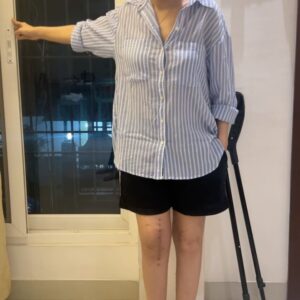 Dhivyadharshini Instagram - Long post alert 
Last 3 months have been trying times for me. 2 months ago I had a major surgery for my knee, yes I have done total knee replacement surgery, this is my 4th surgery is past 10 years on my right knee. Wishing and hoping and praying that this the final surgery for my right knee. By far it’s been a very painful recovery but with improvement. I’m working very hard on myself and my knee. After 2 months of surgery I’m putting up this post for people who loved me onscreen, and have always supported me and empathised with my pain. I’m still in wonder thinking what I’ve done to gain this unconditional love from all of you. And for the people who prayed for me all these years and who supported me at work I want to say a big THANK YOU from the bottom of my heart. It kept me going through my dark days. And I’ve always told myself not to let this pain make me a bitter person and your love aided me in doing that. Now that there is light, I promise to come back stronger (which I already am). 

Most importantly I want to thank my doctors, Dr.Suriyanarayanan sir, Dr.Clement sir, Dr.Ashok sir @sims_hospitals who performed these knee surgeries on me and who took care of me like their own. Also Dr. Suresh and Dr.Madhavan from other departments of Sims hospital. Dr. Raneesh, thank you for always helping me and many thanks to Dr. Amar Agarwal sir (eye hospital) who introduced me to Dr. Clement where it all started. I specially have to thank Dr. Karthik Anjeeneyan, who’s been my support system. Spl mention to SIMS hospital staff Prema ma’am, Dwaraka ji and many who took care of me so well (not a paid mention). 
Big thanks to my family and friends who were by my side (you know who you are)

Lastly, if you ever see me anywhere walking, and if you’re one of those who wished me well during these tough 10 years please come to me and say hi, I would like to count my blessings.

I’m getting stronger, will see you all soon 
New knee New me. 

Love 
DD Neelakandan ❤️🧿