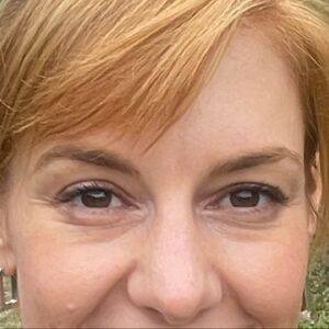 Eva Schulz Instagram - Frisch getestet: Urlaub hilft da auch nicht (war aber trotzdem richtig schön!) #augenringe #itiswhatitis