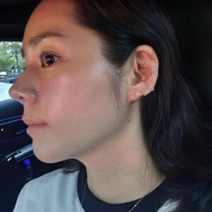 Han Ga-in Instagram - 요즘 컨디션 너무 안좋아서 오늘은 이혈테라피 해봤어요 ㅜㅜ 효과있기를...이와중에 이지듀♡덕에 피부컨디션은 좋네
