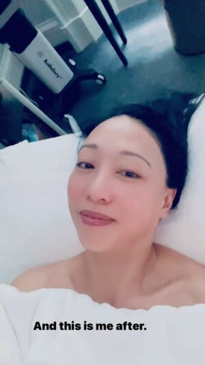 Judy Joo Instagram - I love getting facials. It is probably the one thing I do the most to treat myself on a regular basis. I feel like I have congested skin and need to get my pores cleaned. I have been all around London and New York trying treatments, and my functional medical doctor told me to check out Nataliya Robinson’s beauty clinic @nataliya_robinson_ 
.
Nataliya is called “the skin whisperer” and her treatment was the closest to a medical facial I have ever had outside of Seoul. Very impressed. First, she examined my skin and then designed a bespoke treatment for me. She did extractions (which I need and love), surgically popped a zit (can’t even tell now where it was), and even put an infrared light on an area where I have psoriasis.  The best was her famous and totally intense facial massage. Loved it!  I also really enjoyed the lymphatic drainage leg suit that she strapped me in for the duration of my treatment. Your whole body feels “worked” over and relaxed by the end. I think I fell asleep for a bit too. 
In the end, I came out with glowing and hydrated skin!  And my legs felt awesome too after being massage for 90mins!
.
Nataliya is so knowledgeable and you can tell she really cares as well. You just feel safe with her and trust her to work her magic. She is London’s skin whisperer! 
.
#facial #facials #london #beauty #beautytips #skin #skincare  #judyjoo #lifestyle #invited