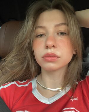 Katelyn Nacon Instagram - Swipe for the #1 underbite in Florida
