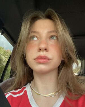 Katelyn Nacon Instagram - Swipe for the #1 underbite in Florida
