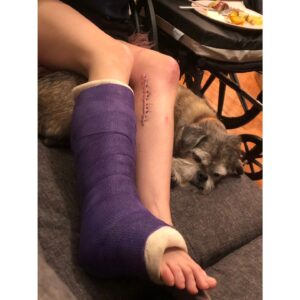 Kathryn Prescott Instagram - 3 years, 11 surgeries, 1 new artery, 2 new ACLs, 7 metal bone reinforcements, 10 frozen eggs, 3 years of physical therapy, 4 screws removed (and kept), 4 new hair cuts/colours (note to self: you cannot control your dysfunctional body by changing your hair). It wasn't all shit :)