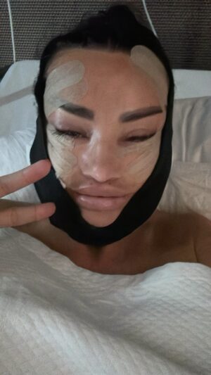 Katie Price Instagram - Trust the Process x

#surgery #face #facelift