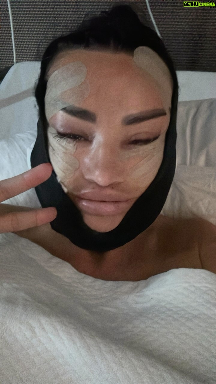 Katie Price - 22.7K Likes - Trust the Process x
#surgery #face #facelift