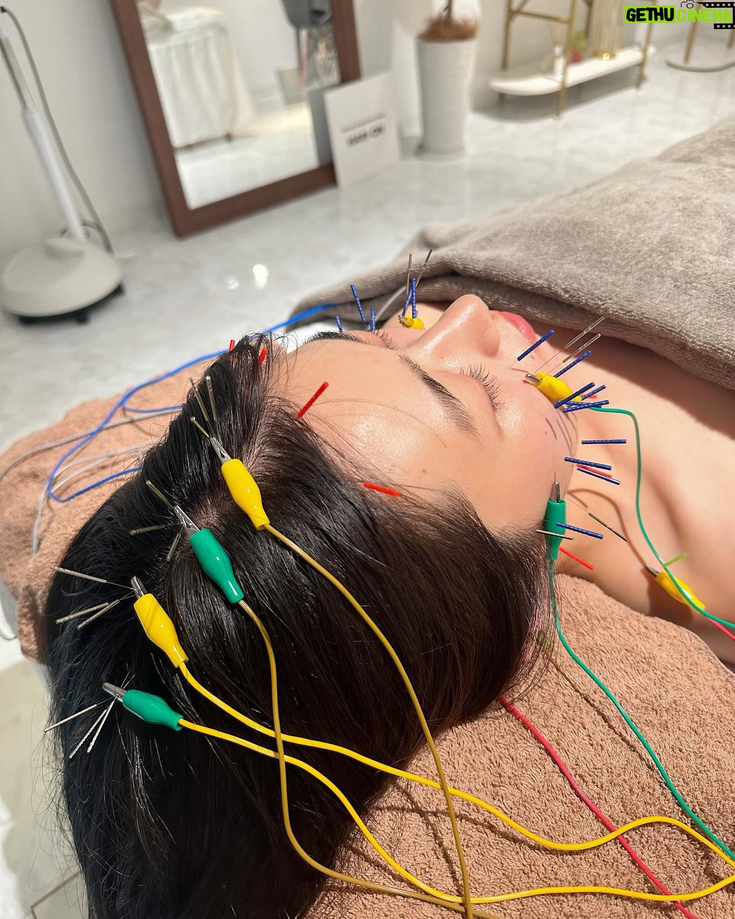 Konomi Naito - 1.9K Likes - 5回目鍼メンテ行ってきました🪡
@harion_beauty
最近、二日酔いやら消化不良で胃熱が頭に上がって
頭皮が熱くなっているとのことで
今回は頭を重点的にやってもらいました❤️🔥
相変わらず眼精疲労もやばくて
刺した瞬間筋肉がズーンてなった
頭の悪い血も抜いてもらってなんだかスッキリ😌✨
手足にお灸もしていただき
やはり施術後は顔のむくみとれていい感じ!
とにかくリラックスできて寝ちゃった😂
また再来週宜しくお願いします👍