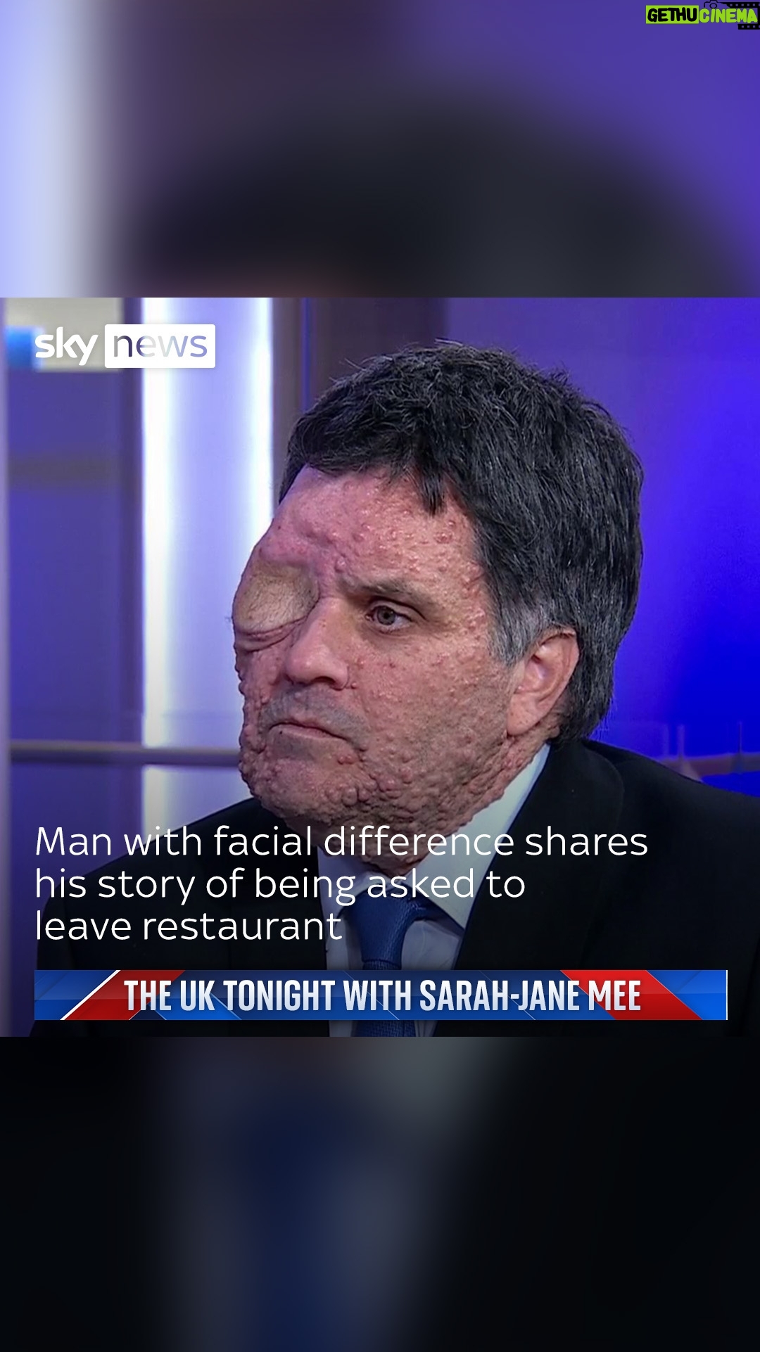 Sarah-Jane Mee - 1.5K Likes - Oliver Bromley has Neurofibromatosis type 1 (NF1), which causes tumours to grow in the nervous system and skin.
He was turned away by restaurant staff because he was 'scaring customers' - a hate crime.
He tells @skysarahjane his story.
#hatecrime #facialdifference