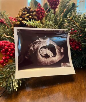 Georgina Bloomberg Instagram - There were a lot of wonderful things under the tree this year, but the best gift these boys found wasn’t from Santa, and won’t be officially delivered until this spring. 💕👶🏻🎄🎁