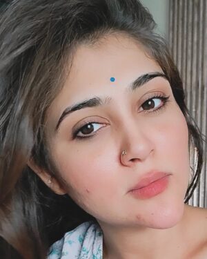 Hiral Radadiya Instagram - I took a normal selfie and posted it directly but a pimple  appear on my face and it is a simple picture