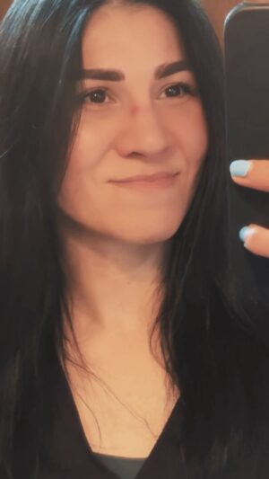 Irene Aldana Instagram - Pronto les compartiré cómo he llevado el tratamiento para mi cicatriz junto con el doctor @drvazquez_life 

#scar #selfcare #ufc