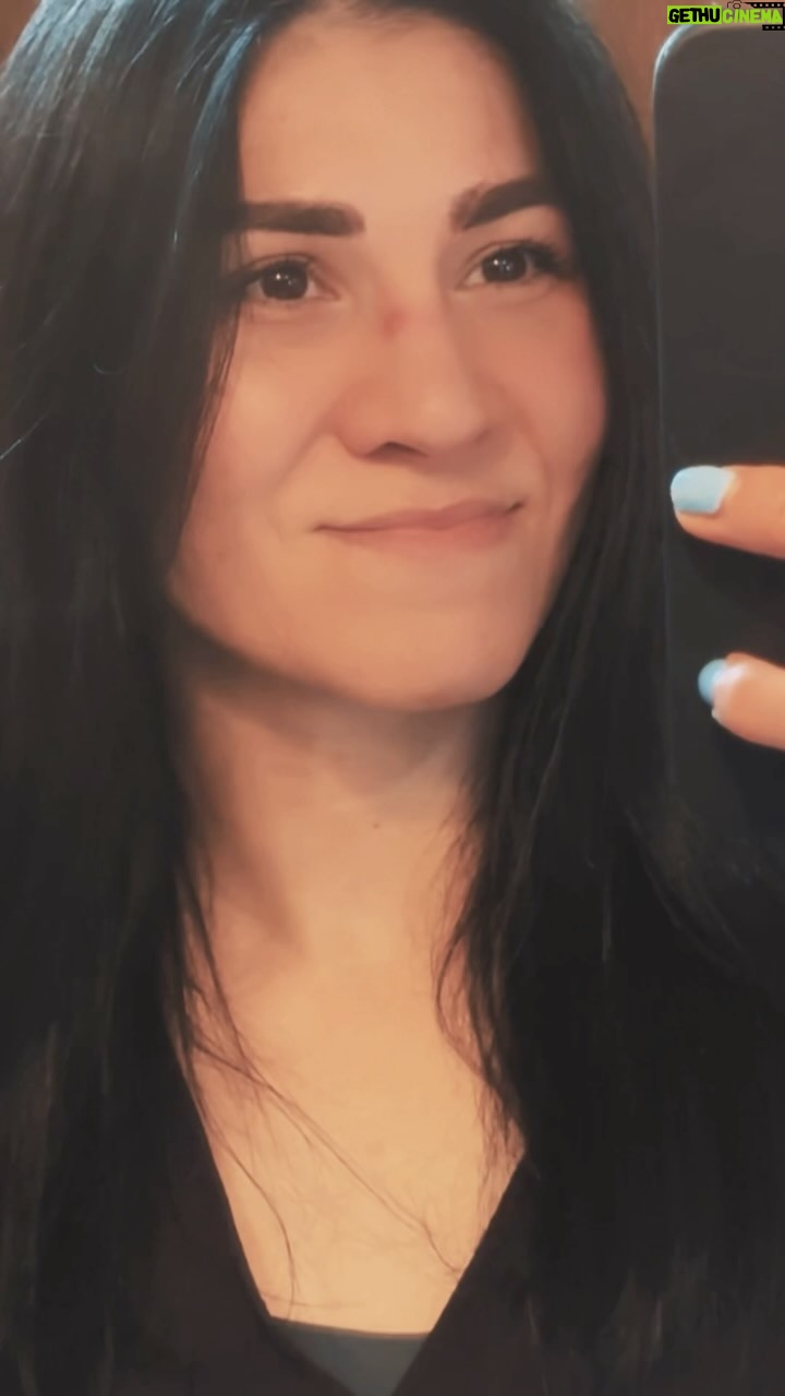 Irene Aldana - 16.6K Likes - Pronto les compartiré cómo he llevado el tratamiento para mi cicatriz junto con el doctor @drvazquez_life
#scar #selfcare #ufc