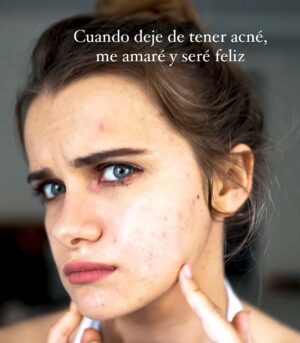 Marina Yers Instagram - He llorado creando este post. 

La verdad es que toda mi adolescencia y parte de mis 20 estuve persiguiendo sueños vacíos, dopamina momentánea, y cosas materiales como si fuese lo más importante. 

Me tuve que dar muy muy buenas hostias en la vida, para darme cuenta de que eso NO estaba NI CERCA de lo que verdaderamente me haría feliz. 

Era un “agujero para conejos”. La fama, el dinero, el estatus, el poder… Todo eso lo es. 

Lo único que me hizo cambiar de verdad, fue Dios. 
Pidiendo mucho a Dios encontré mi lugar en el mundo, un entorno sano, felicidad en las cosas más simples y mucho amor y empatía, allá donde vaya. 

GRACIAS DIOS por liberarme de todas esas cadenas y mostrarme el camino correcto. 

Ahora si soy una persona plena y feliz. De corazón. 

#diosesamor #felicidadtotal #serfeliz #felicidadplena #diosteama #diostehabla #desarrollopersonal #vivirmejor