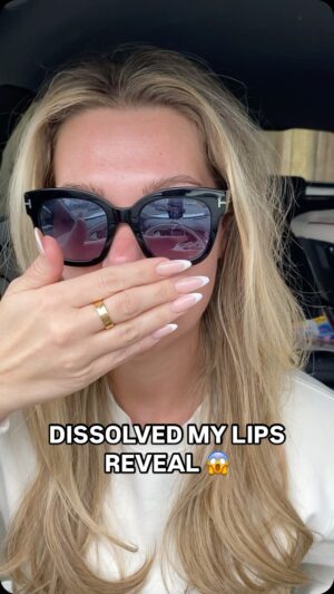 Shaughna Phillips Instagram - DISSOLVE MY LIPS WITH ME 😱😳

I finally done it, I’m actually pleasantly shocked with how I feel about them, I’m calling that growth 🤪