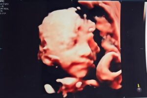Son Dam-bi Instagram - 3D 입체 초음파
누구 닮은 것 같아?😊
난 남편인 것 같기도 하고🤣🤣👶🏻