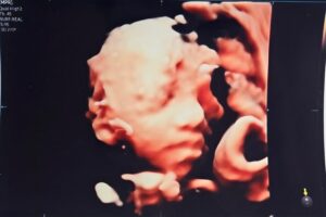 Son Dam-bi Instagram - 3D 입체 초음파
누구 닮은 것 같아?😊
난 남편인 것 같기도 하고🤣🤣👶🏻