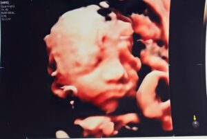 Son Dam-bi Instagram - 3D 입체 초음파
누구 닮은 것 같아?😊
난 남편인 것 같기도 하고🤣🤣👶🏻