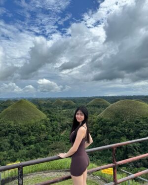 Azi Acosta Instagram - Sunburned bare face in bohol💕