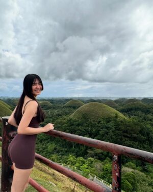 Azi Acosta Instagram - Sunburned bare face in bohol💕