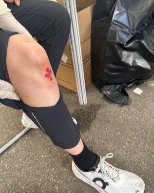 Natalie Tong Instagram - 完成啦
🏃‍♀️🏃‍♀️🏃‍♀️🏃‍♀️🏃‍♀️🏃‍♀️
今日天氣超好
一路跑呼吸暢順冇氣喘
成績比上年快咗11分鐘
我滿意㗎
但教練就覺得可以再快啲囉
😂😂
另外要感謝一班醫護人員
開跑時多人click一click 
無檢查傷勢就一路跑
跑完返嚟先發現自己流血
多謝你哋好溫柔地幫我洗傷口
 🩵🩵🩵
下年再見

#名副其實跑到有血有汗
#NT